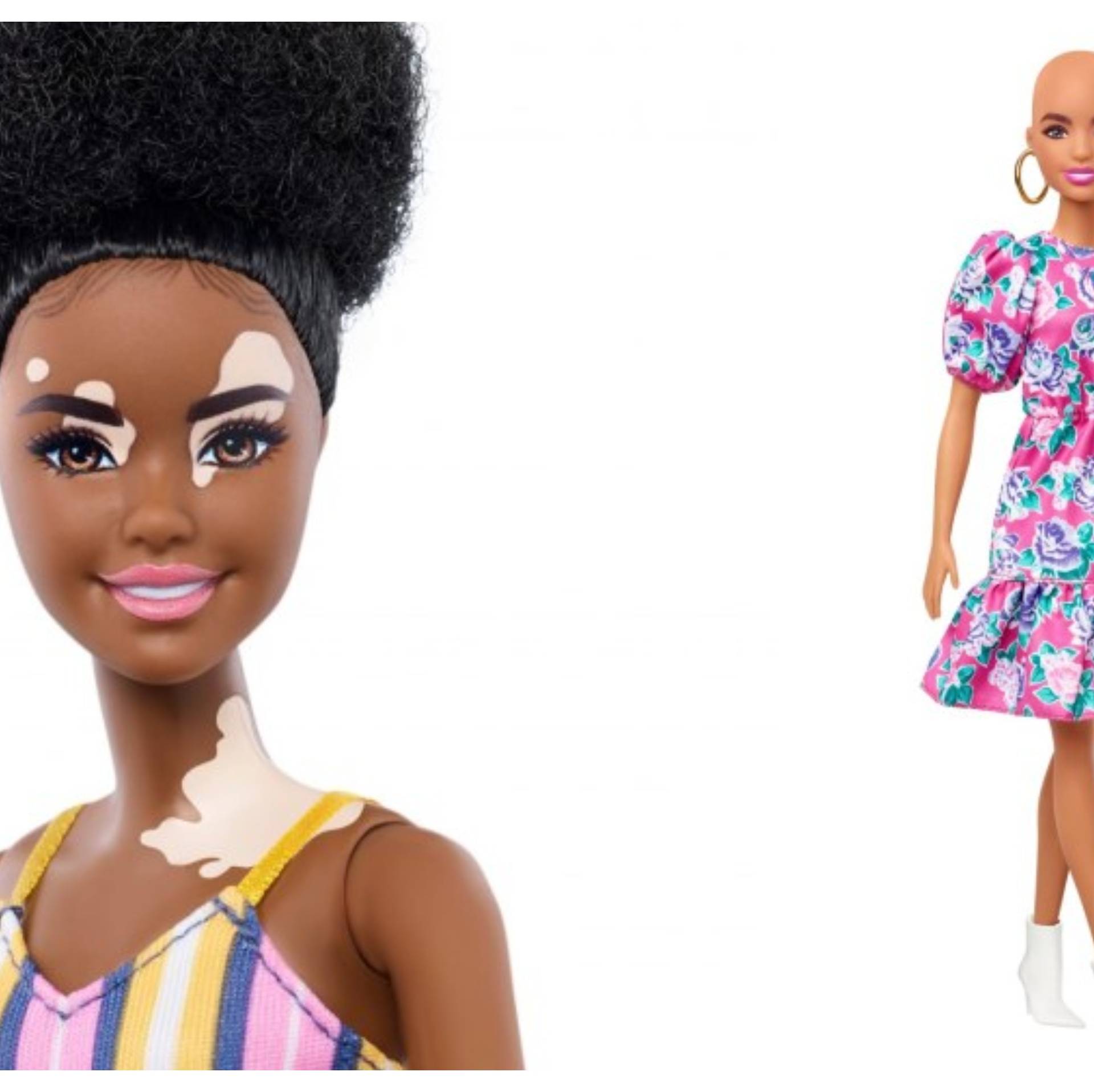 Šalju prekrasnu poruku djeci: Mattel lansirao Barbie lutke koje imaju vitiligo i alopeciju