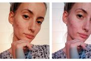 Beauty blogerica: "Je l' vam se digne samopouzdanje kad nekome tko ima akne kažete da posjeti kozmetičarku ili dermatologa?"