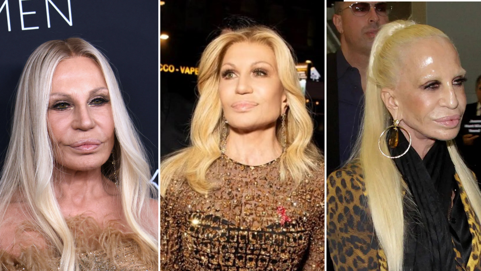 Donatella Versace oduševila novom fotkom: 'Uspjela je poništiti sve estetske operacije?'